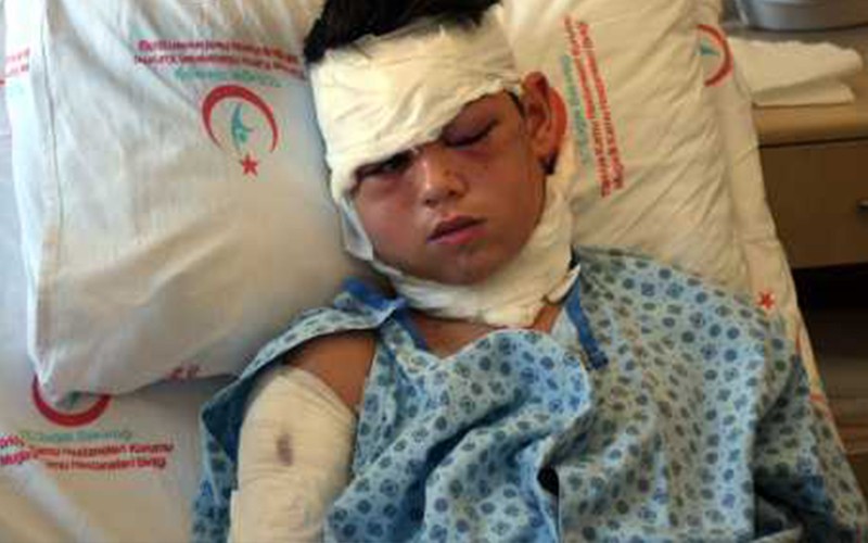 arena datça da köpekler saldırdı