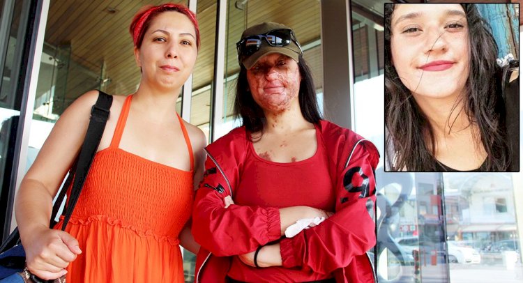 BERFİN ÖZEK TEDAVİ İÇİN BODRUM’DA…